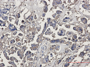 beta III Tubulin Rabbit mAb Antibody