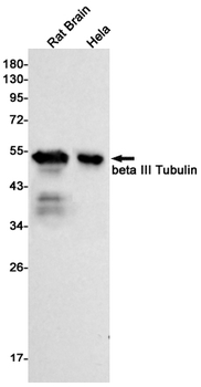 beta III Tubulin Rabbit mAb Antibody