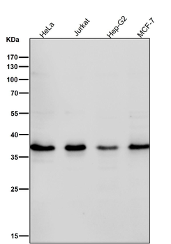 Rad51 Rabbit Monoclonal Antibody