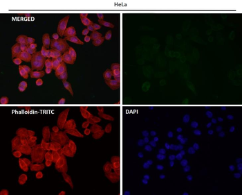Rad51 Rabbit Monoclonal Antibody