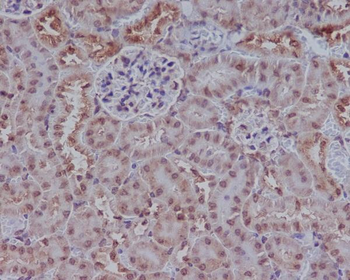 Rad51 Rabbit Monoclonal Antibody