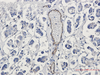Poliovirus Receptor Rabbit mAb Antibody