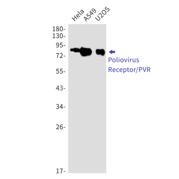 Poliovirus Receptor Rabbit mAb Antibody