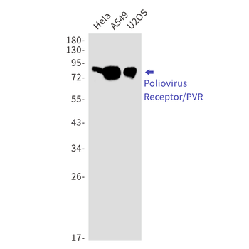 Poliovirus Receptor Rabbit mAb Antibody