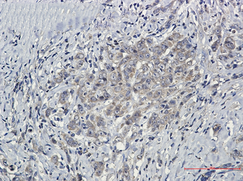 SHP2 Rabbit mAb Antibody
