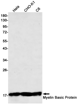 Myelin Basic Protein Rabbit mAb Antibody