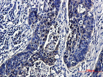 IGF1 Receptor Rabbit mAb Antibody