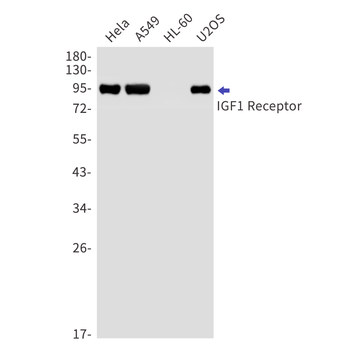 IGF1 Receptor Rabbit mAb Antibody