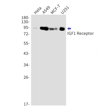 IGF1 Receptor Rabbit mAb Antibody