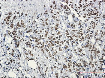 Hsf1 Rabbit mAb Antibody