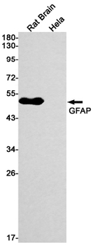GFAP Rabbit mAb Antibody