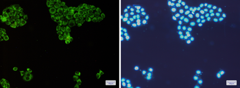 PKR Rabbit Monoclonal Antibody