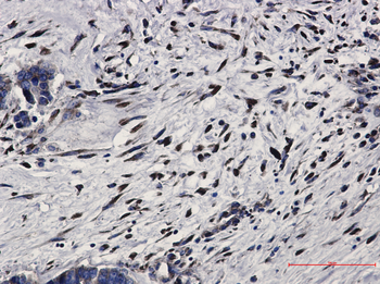 PKR Rabbit Monoclonal Antibody