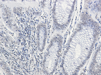 CPS1 Rabbit mAb Antibody