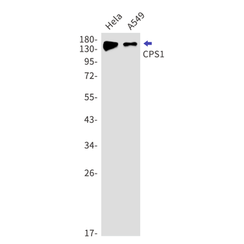 CPS1 Rabbit mAb Antibody