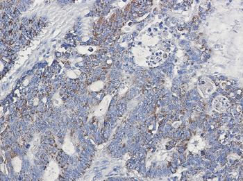 CD147 Rabbit Monoclonal Antibody