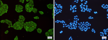 STUB1 Rabbit mAb Antibody