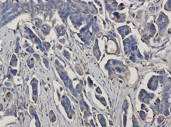Peroxiredoxin 3 Rabbit mAb Antibody