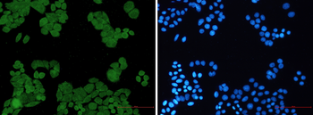 PP2A alpha/beta Rabbit mAb Antibody