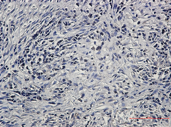 PP2A alpha/beta Rabbit mAb Antibody