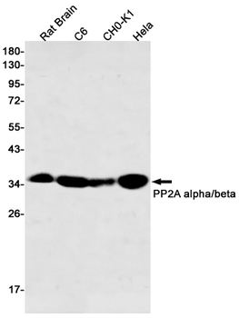 PP2A alpha/beta Rabbit mAb Antibody