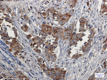 Niemann Pick C2 Rabbit mAb Antibody