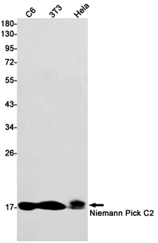 Niemann Pick C2 Rabbit mAb Antibody