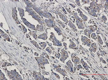 NDUFS1 Rabbit mAb Antibody