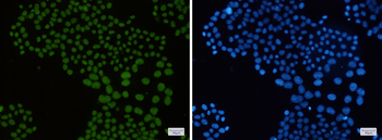 Macro H2A.1 Rabbit mAb Antibody