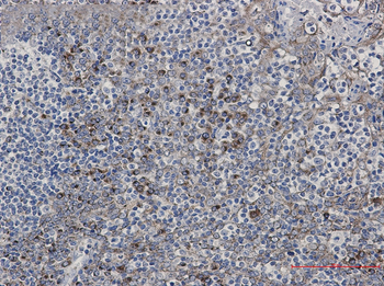 LMAN1 Rabbit mAb Antibody