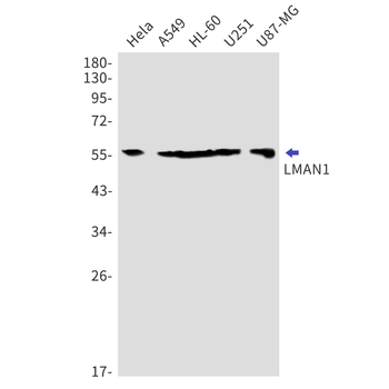 LMAN1 Rabbit mAb Antibody