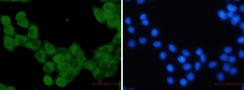 KIF5B Rabbit Monoclonal Antibody