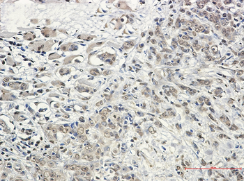 KIF5B Rabbit Monoclonal Antibody