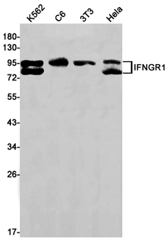 Interferon gamma Receptor 1 Rabbit mAb Antibody