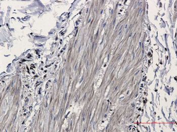 IDH1 Rabbit mAb Antibody