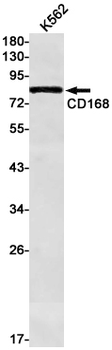 CD168 Rabbit mAb Antibody