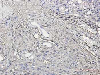 GAP43 Rabbit Monoclonal Antibody