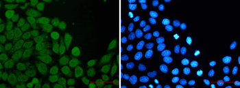 eIF4A3 Rabbit mAb Antibody