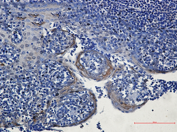 eIF4A3 Rabbit mAb Antibody
