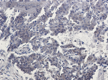 CREB Regulated Transcription Coactivator 2 Rabbit mAb Antibody