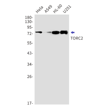 CREB Regulated Transcription Coactivator 2 Rabbit mAb Antibody