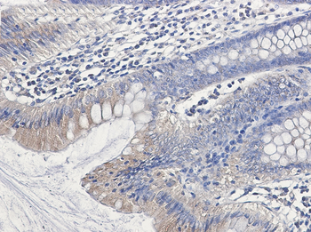 Clathrin Heavy Chain Rabbit mAb Antibody