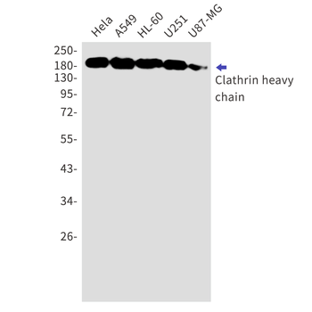 Clathrin Heavy Chain Rabbit mAb Antibody