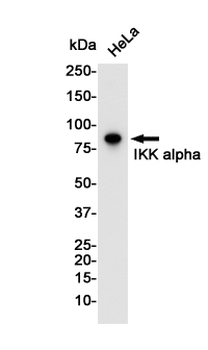 IKK alpha Rabbit mAb Antibody