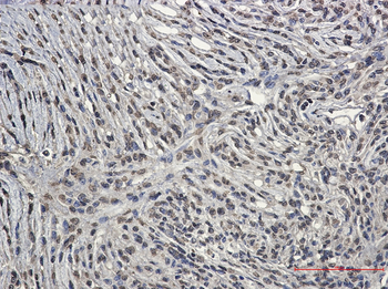 Bcr Rabbit mAb Antibody