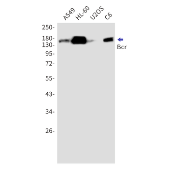 Bcr Rabbit mAb Antibody
