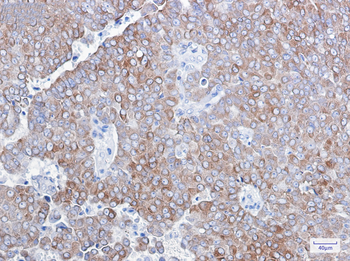 Bcl2 Rabbit mAb Antibody