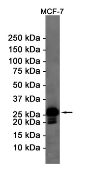 Bcl2 Rabbit mAb Antibody