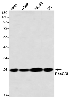 RhoGDI Rabbit mAb Antibody