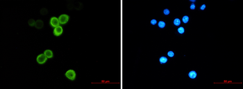 Anterior Gradient 2 Rabbit Monoclonal Antibody